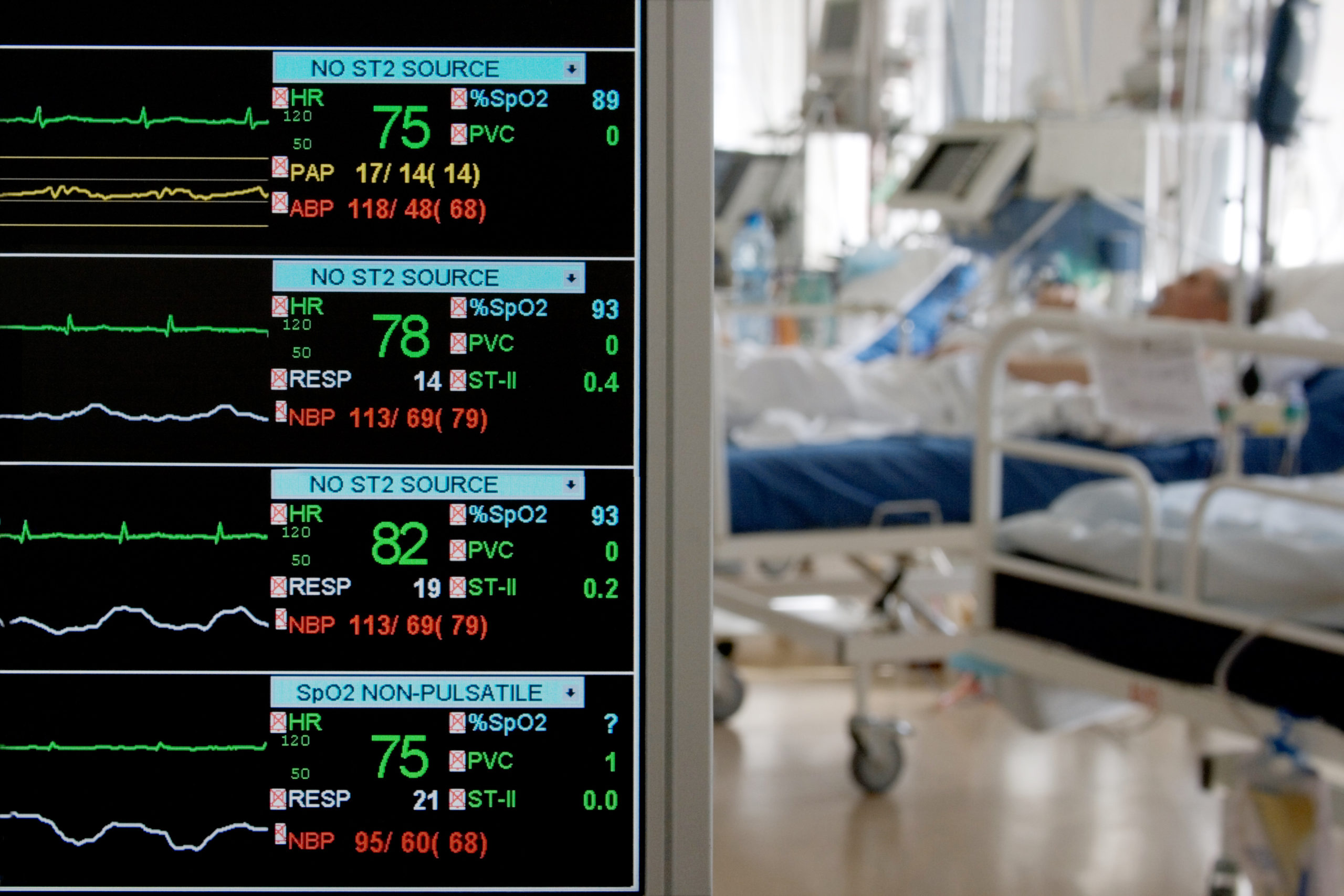 Quarterly Thought Conference: eICU Care